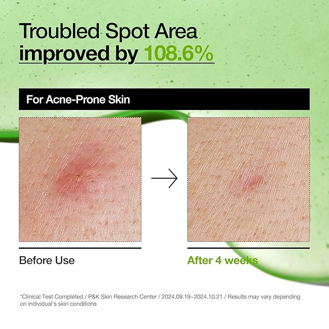 ANUA Sérum Apaisant Azélaïque 30ml ( peau grasse )