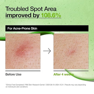 ANUA Sérum Apaisant Azélaïque 30ml ( peau grasse )