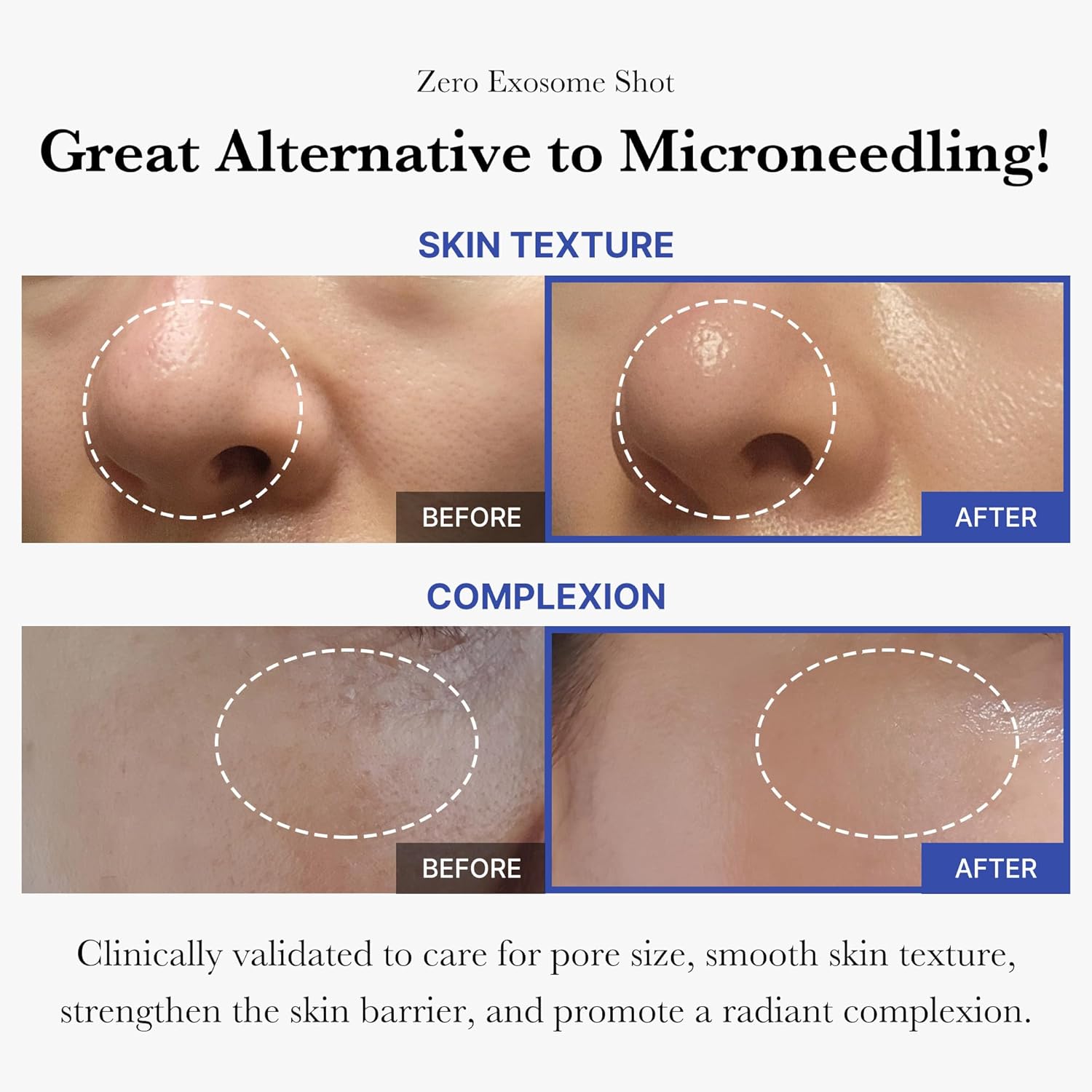 MEDICUBE Zero Exosome Shot 7 500 PPM